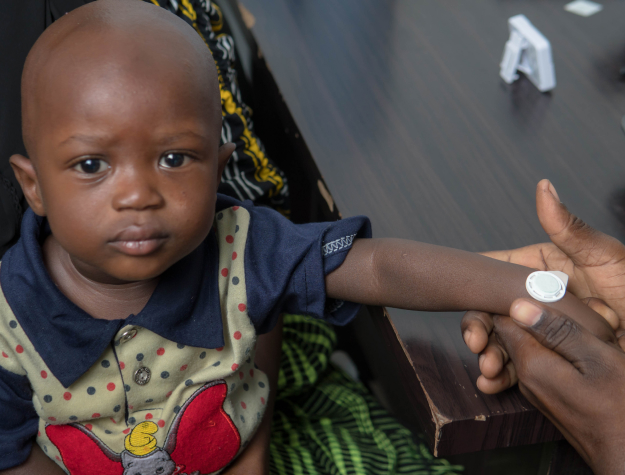 A child with a measles patch on their wrist